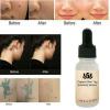 Organic Skin Tags Solutions Serum-3334-01