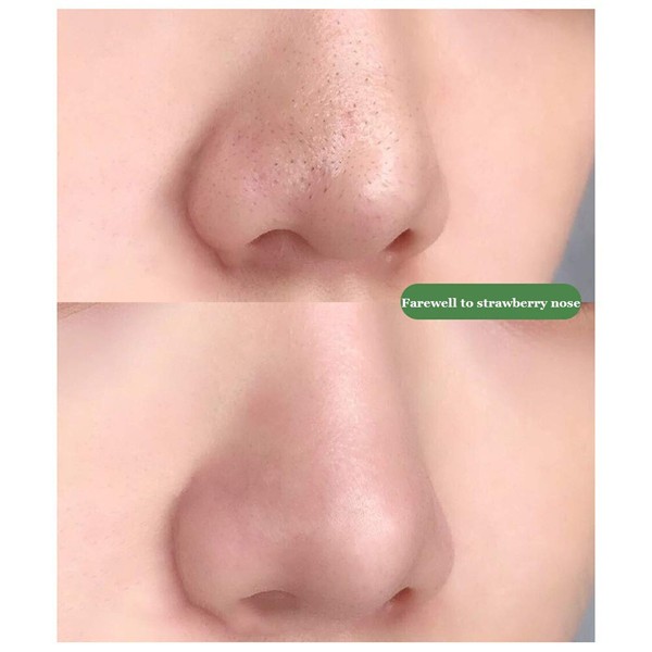 Best Green Mask Deep Cleansing and Pore Cleaner Stick-120