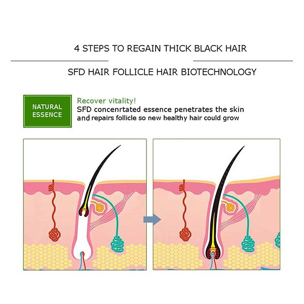 Disaar Anti Hair Loss Essential Oil 30gm-1887